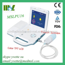 MSLPU16M Hot selling Palm bladder scanner portable ultrasound machine with 8.4 inch TFT color LCD big screen